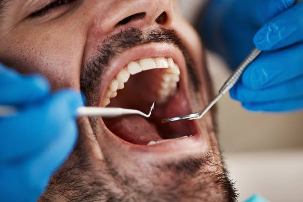 Best Emergency Dental Care for Broken or Chipped Teeth in Mazon, IL