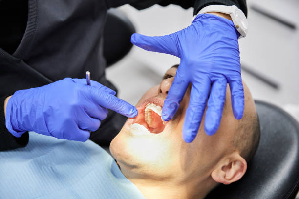 Best Emergency Wisdom Teeth Removal in Mazon, IL